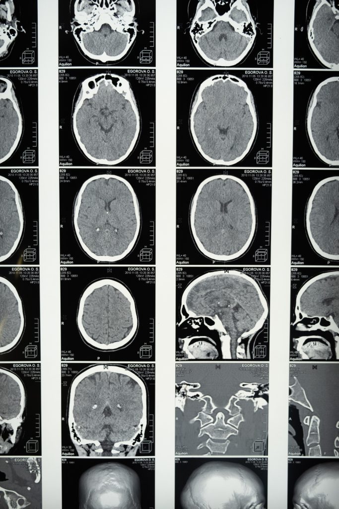 MRI of brain activity during accessing computer program